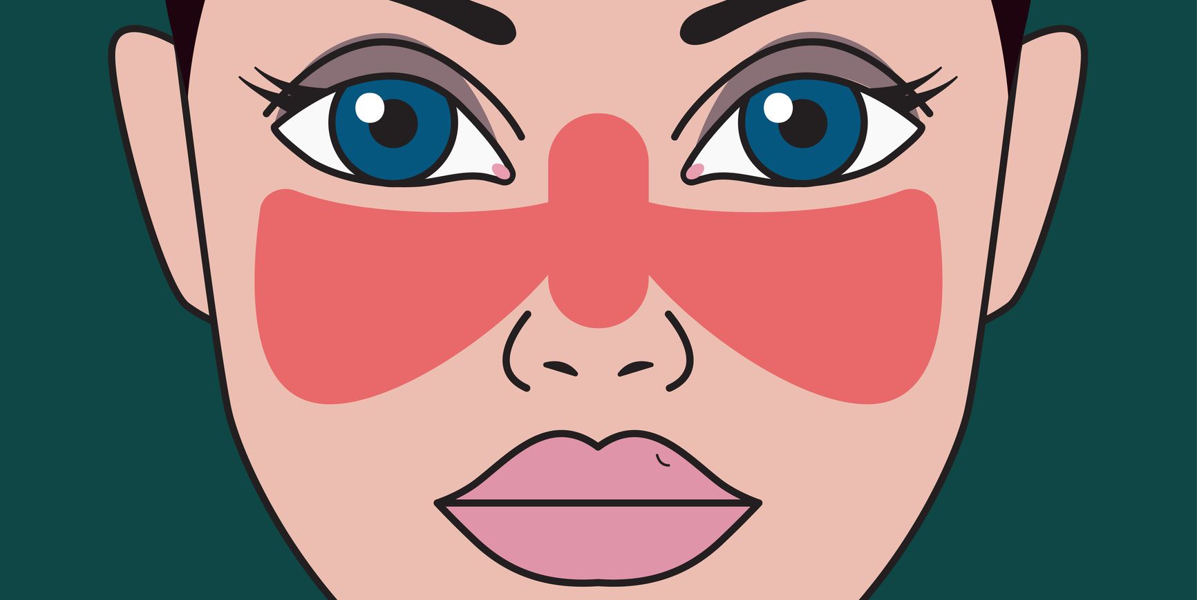 Breaking Barriers: Lupus Market Entry Strategies for Success | DLI