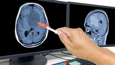 Market Dynamics and Entry Strategies: A Roadmap for Brain Cancer Therapeutics| DLI