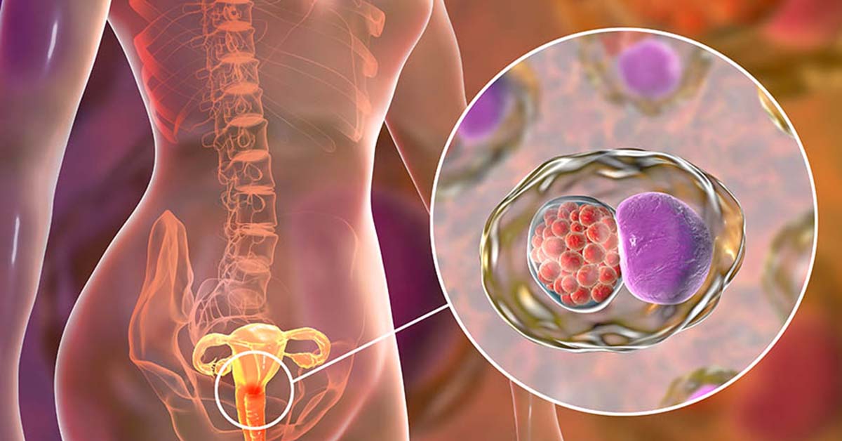 Decoding Chlamydia: Symptoms, Prevention, and Market Analysis | DLI