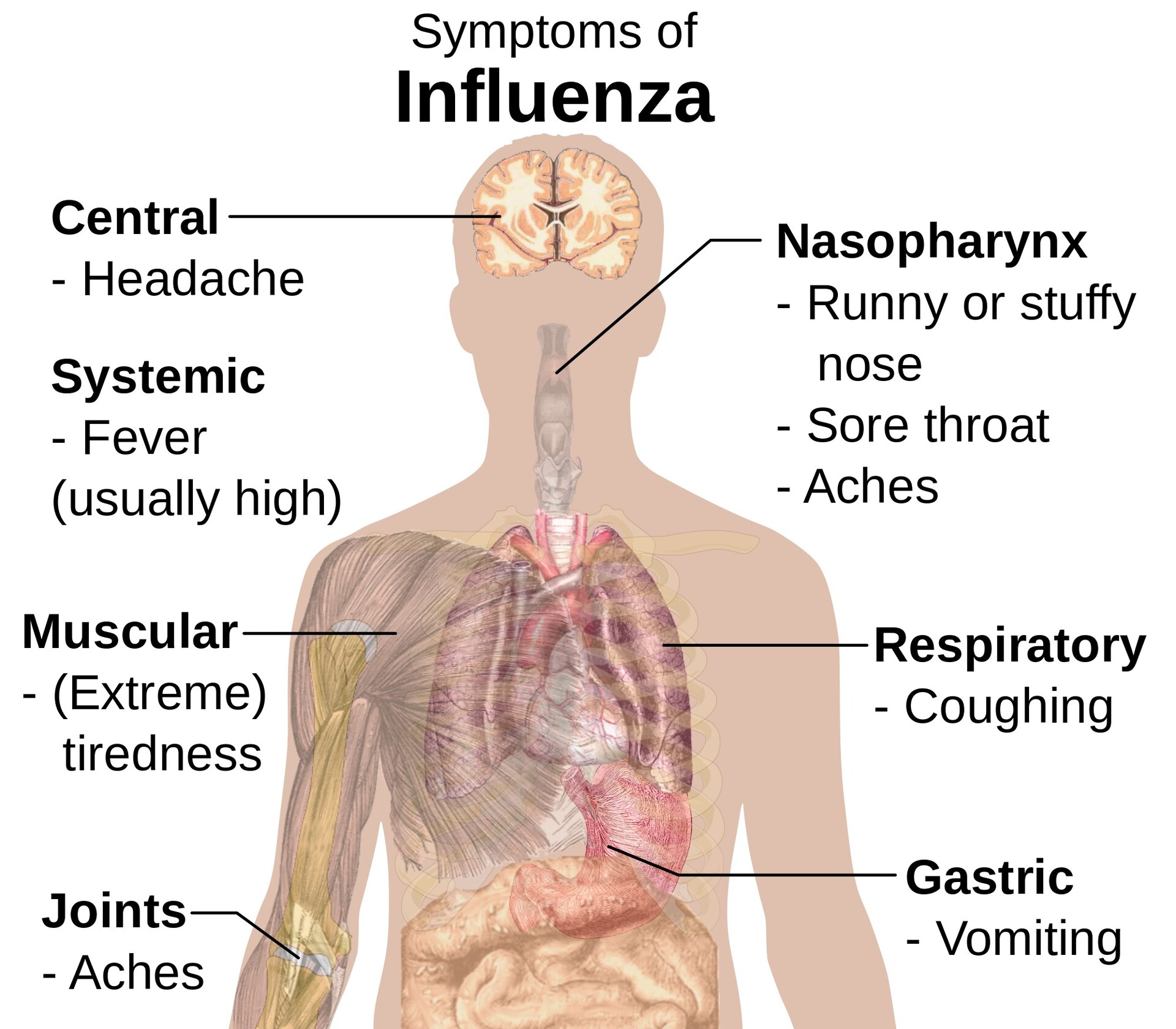 Unlocking the Potential: DLI’s Expertise in Influenza Market Access| DLI