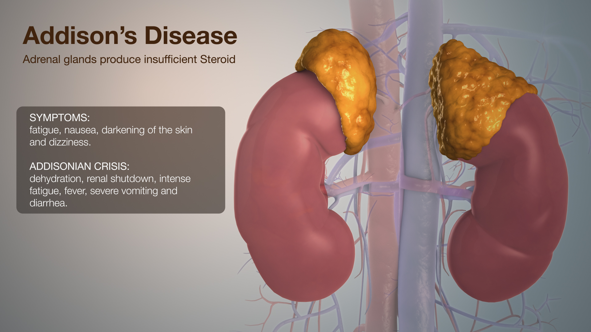 Market Dynamics and Regulatory Insights: Autoimmune Addison Disease